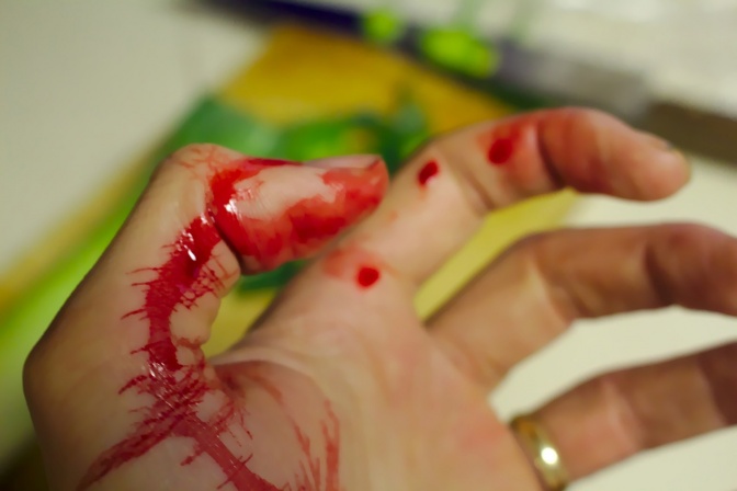 Eine Hand mit einer blutenden Verletzung am Daumen.